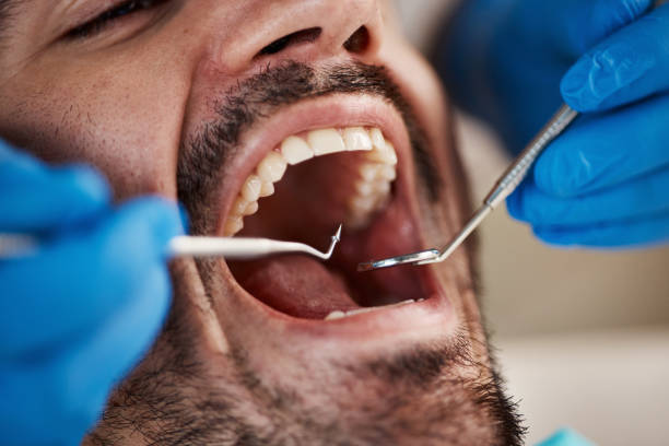 Best Pediatric Emergency Dentist in Derwood, MD